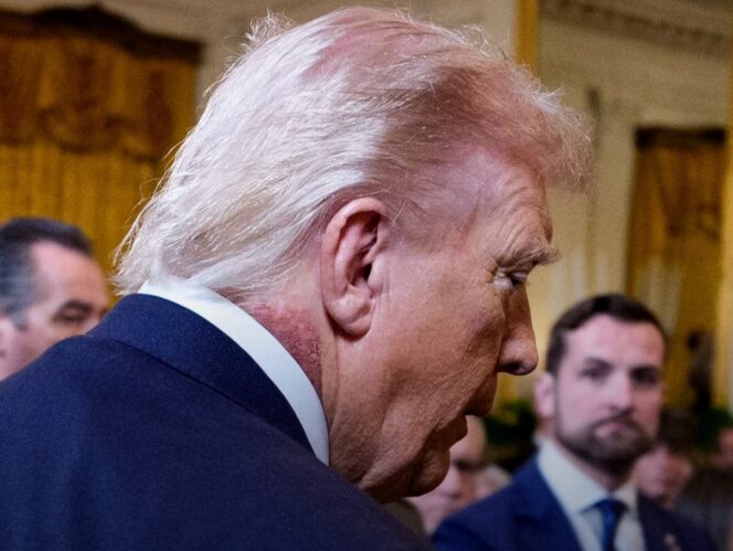 
					Kesehatan Donald Trump Jadi Sorotan, Usai Timbul Ruam Merah Pada Leher Sang Presiden